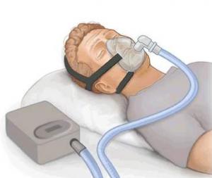 Cheap Portable Medical Ventilator Machine 00-240 V For Icu Breathing Apparatus wholesale