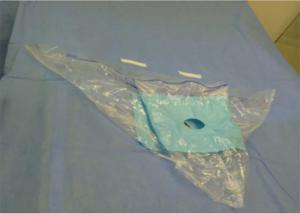 Cheap Knee Arthroscopy Fluid Collection Bag Disposable Sterile Surgical Drape Support wholesale
