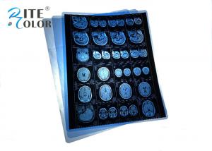 China Waterproof PET Blue Medical X Ray Film For MRI CT CR Dental Panorama Images Output on sale
