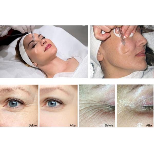 Deep Skin Clean Water Jet Peeling Oxygen Facial Machine