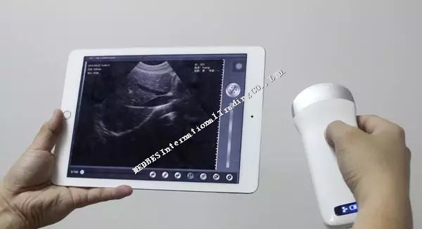 Apple IPAD mini/IPAD air/IPHONE,Android PhonesWireless Ultrasound Scanner