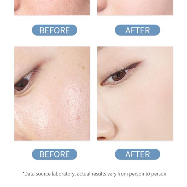 Bodycare Whitening Body Lotion Remove Black Spots And Dark Yellow Skin Care