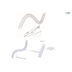 Precision Placement Ureteric Stents Hydrophobic Surface And X Ray Visibility