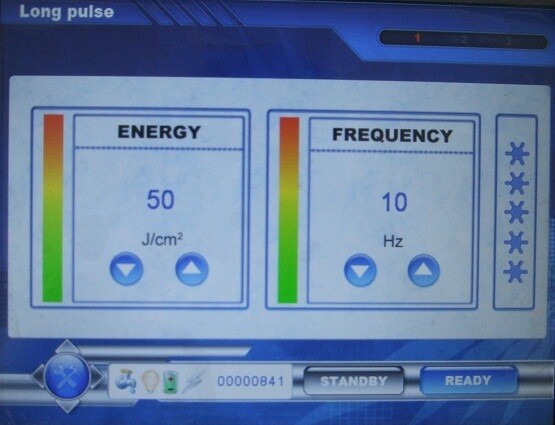 three wavelengths 1064 755 532nm hair removal permanent no pain hair removal treatment