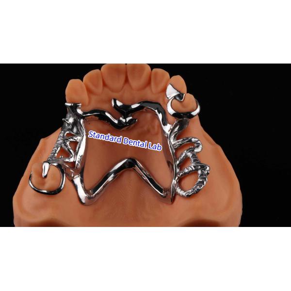 Complete Denture Ivoclar Full Denture Acrylic Teeth SDL Dental Lab