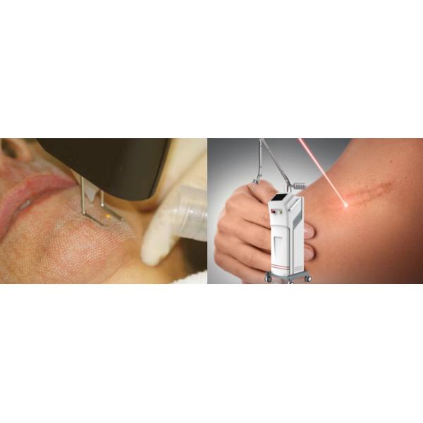 Clinic Salon Portable CO2 Fractional Laser Machine Beauty Salon Equipment For Acne Removal