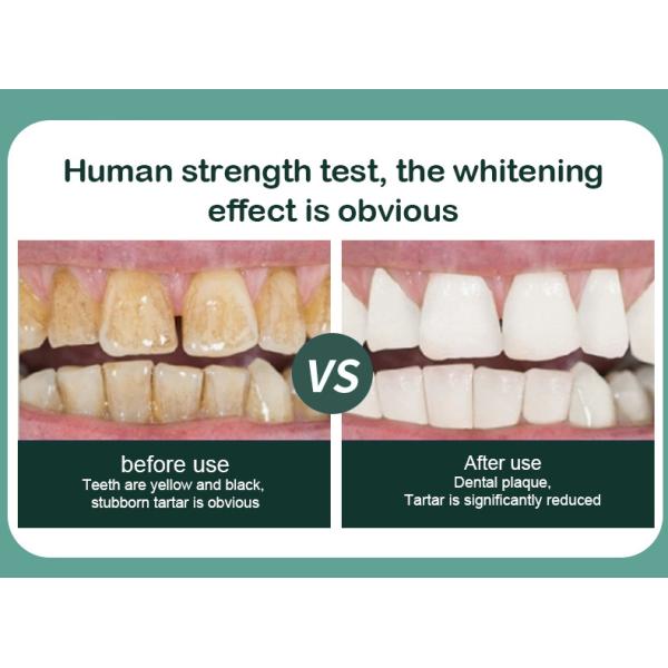 Hd Visual Safe Dental Scaler Portable Tooth Cleaning Tool Sonic Electric Tooth Cleaner