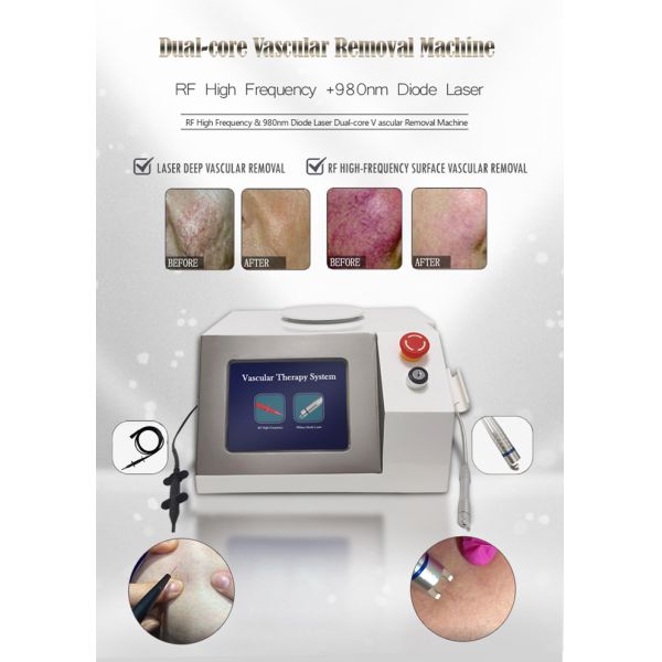 GOMECY RF High Frequency & 980nm diode laser Dual-core Vascular Remover Machine
