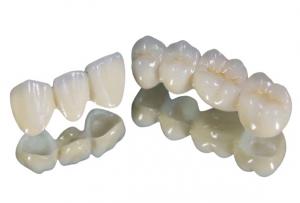 Cheap Porcelain Tooth Crown Strong Wear Resistance Color Stable High Quality wholesale