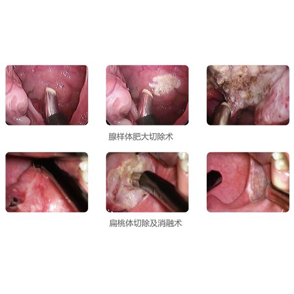 Low Temperature RF Plasma System Cutting Perforation Ablation Cryosurgery Unit