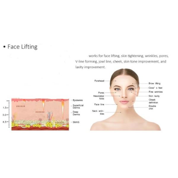 V Line Facial Lifting Mini Portable Rf Beauty Equipment Portable Style 1 Year Warranty