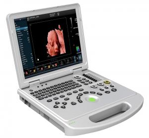 Cheap CE 3D 4D 5D Portable Color Doppler Ultrasound Machine Scanner OEM wholesale