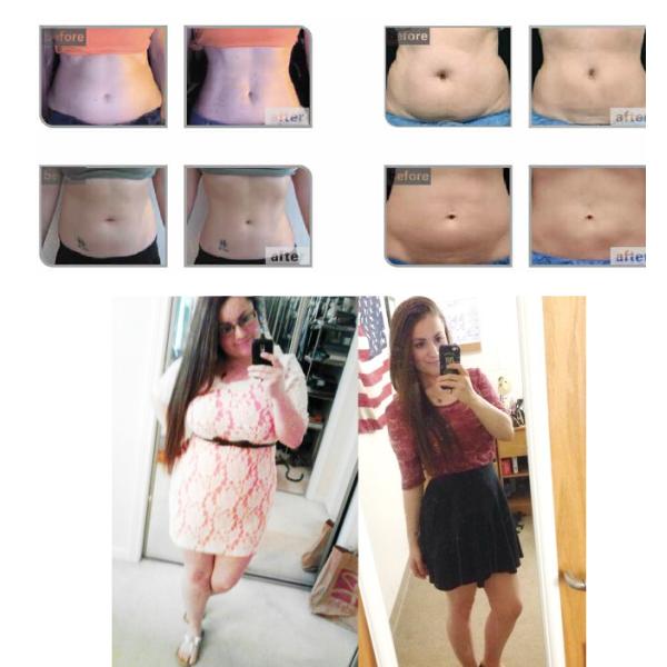 Sales Agent WANTED!!! hifu machine/ high intensity focused ultrasound