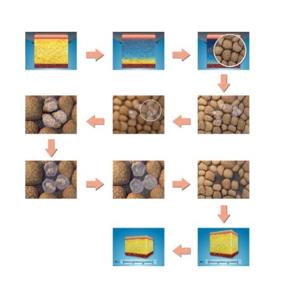 cryolipolysis treatment beauty machine multifunction fat reduction machine