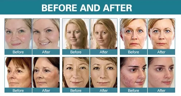 2 In 1 RF Beauty Equipment Skin Tightening Cavitation Slimming 4D Circle Rv Micro Heat Handle Machine