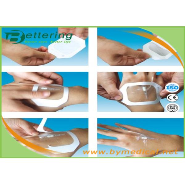 Medical IV Clear PU Film Surgical Dressing , Semi Permeable Dressing Waterproof