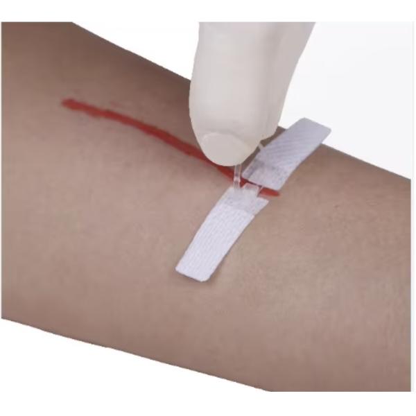 Self Adhesive Dermaclip Stitches Alternative Suture For Skin Closure Non Invasive