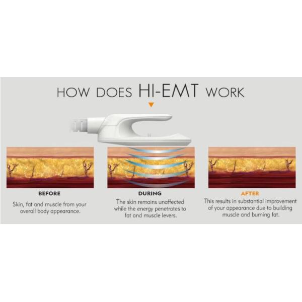 HI EMT Ems slimming machine for muscle training