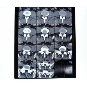 Cheap White PET AGFA Medical Dry Film wholesale