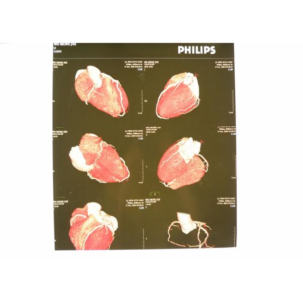 Hosipital PET Film Medical X Ray Paper Waterproof 8 ×10 Inch CT Film White