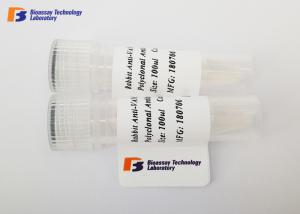 Cheap Neuron Specific Enolase Mouse Monoclonal Antibodies CE / ISO / MSDS Approved wholesale