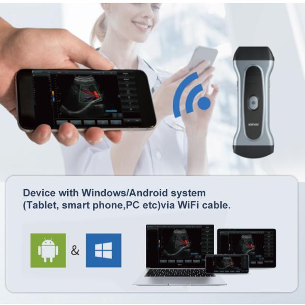 Yonker Pocket Veterinary Ultrasound Scanner Portable Handheld WiFi Color Wireless Ultrasound Probe Vet for Animal Cat Pet Dog