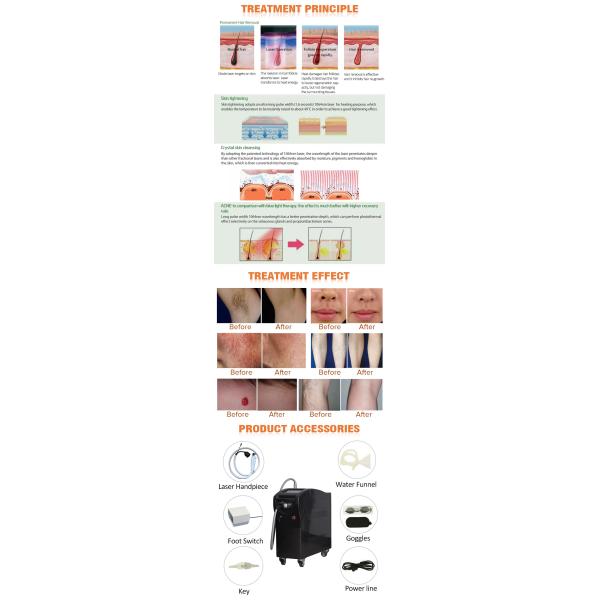 Acne Removal Alexandrite Laser Machine Nd Yag Laser Hair Removal Beauty Machine