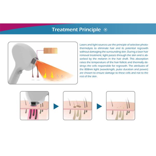 808nm diode laser whole body hair removal machine portable bikini area hair removal