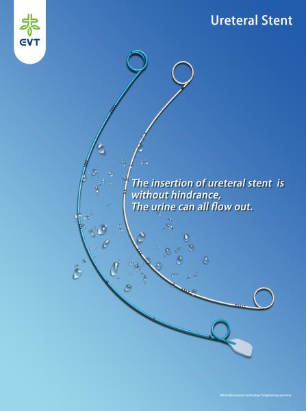 Larger Diameter Ureteral Stent Placement Hydrophilic Allium Stent Surgical