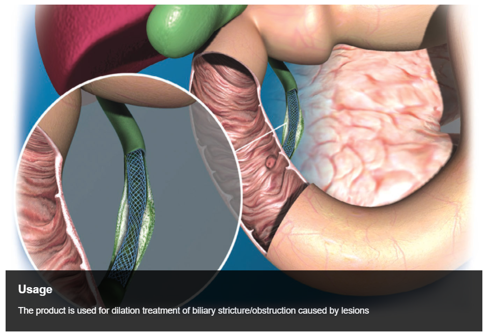Endoscopic Ni-Ti Biliary Stent Disposable Customized Ce Certified