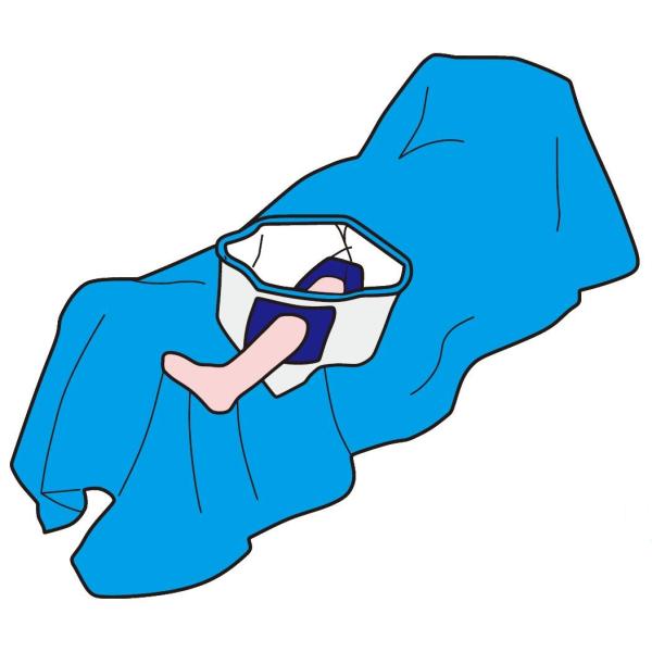 Knee Arthroscopy Disposable Patient Drapes Lower Extremity Orthopedic Class II