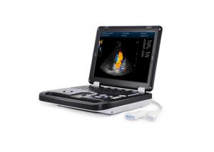 China 256 Portable Ultrasound Scan Machine 3D Digital Portable Ultrasound Scanner on sale