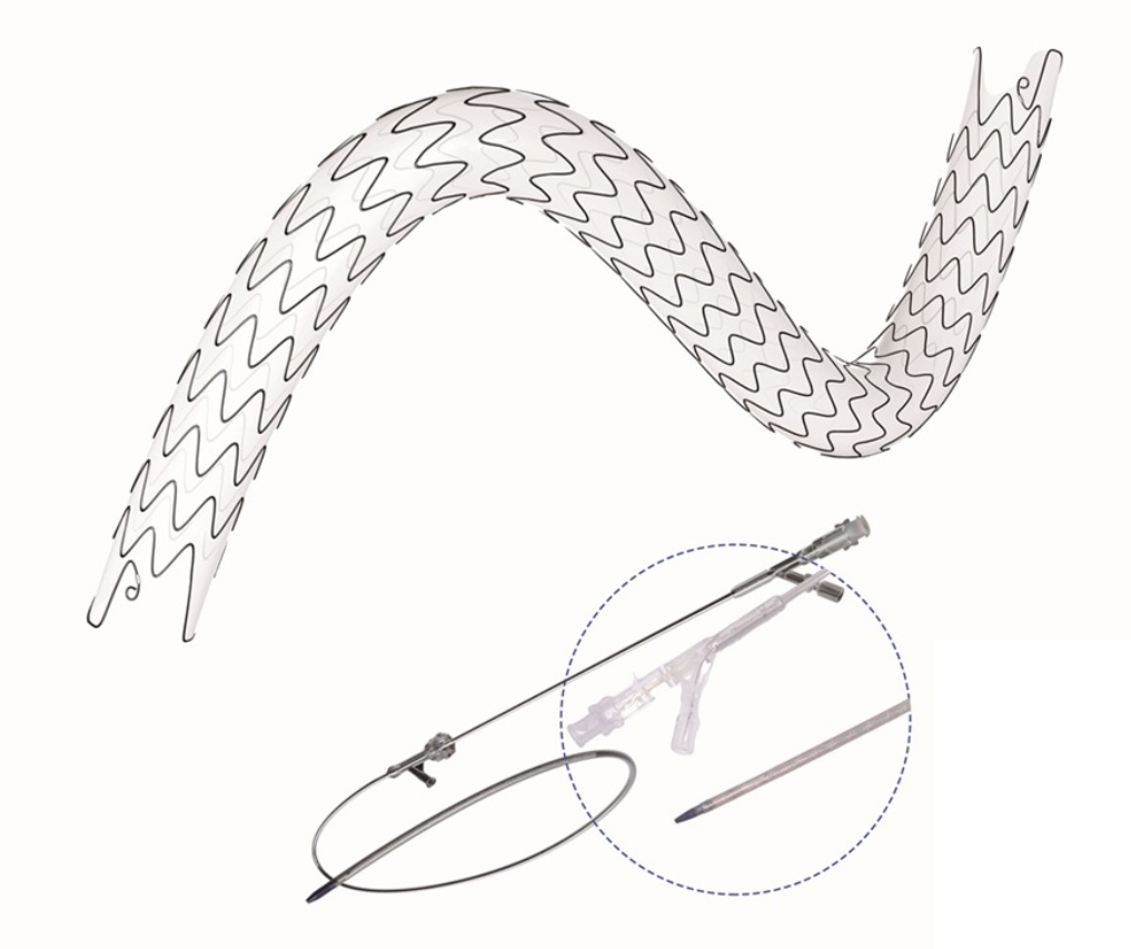 Precision Placement Ureteric Stents Hydrophobic Surface And X Ray Visibility