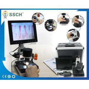 China CE Approved LCD Screen Medical Microscope Capillary Microcirculation on sale