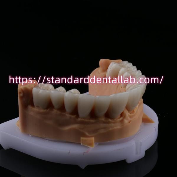 FDA High Esthetics Dental Zirconia Bridge With Layered Porcelain zirconia dental crown China Dental Lab