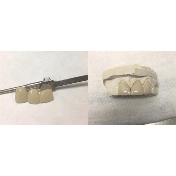 B1 B2 Colours SHT Zirconia Multilayer Block For Veneers Teeth
