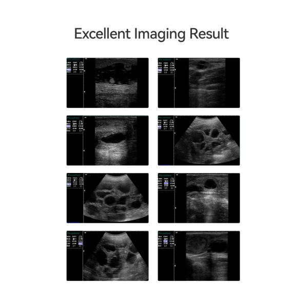 Yonker Portable Ultrasound Machine Ultrasound Machine for Animal/cattle Cow Horse Goat Use Veterinary Instrument