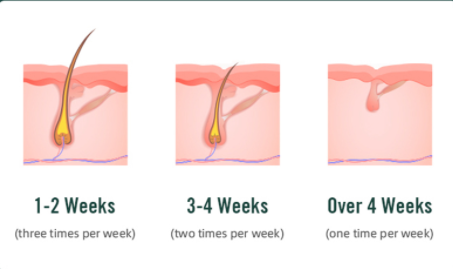 808nm Fast SHR Hair Removal Machine True Uk Lamp Permanent 1 Million Shots Life