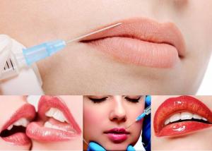 professional manufacturer  Long-lasting hyaluronic acid filler lip enhancement