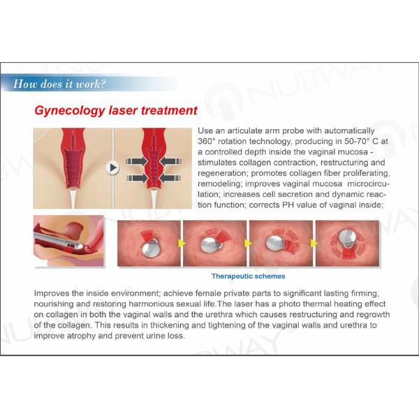 Nubway Top Quality Fractional CO2 40w Co2 For Beauty Clinic Use Medical Laser Treatment Equipment