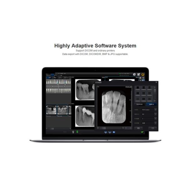 Dental oral Imaging Plate digital X-ray Radiography Imaging System Film Scanner