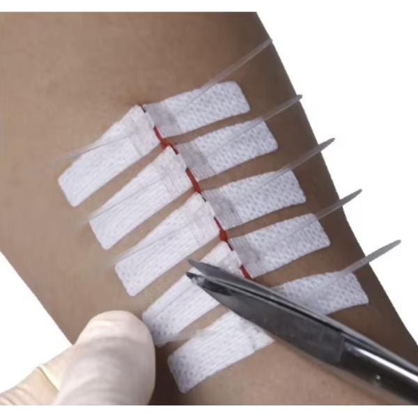 Self Adhesive Dermaclip Stitches Alternative Suture For Skin Closure Non Invasive