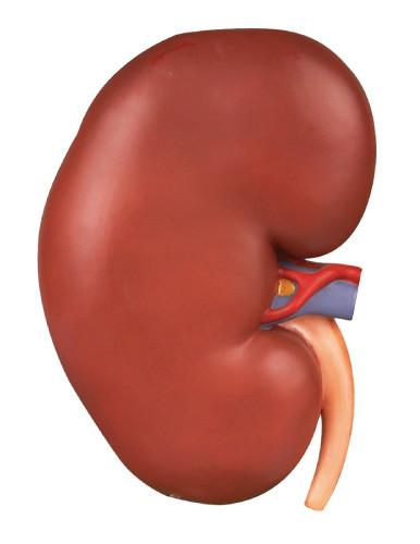Quality Kidney Enlargement Human Anatomy Model Shows the Section for Colleges Training for sale