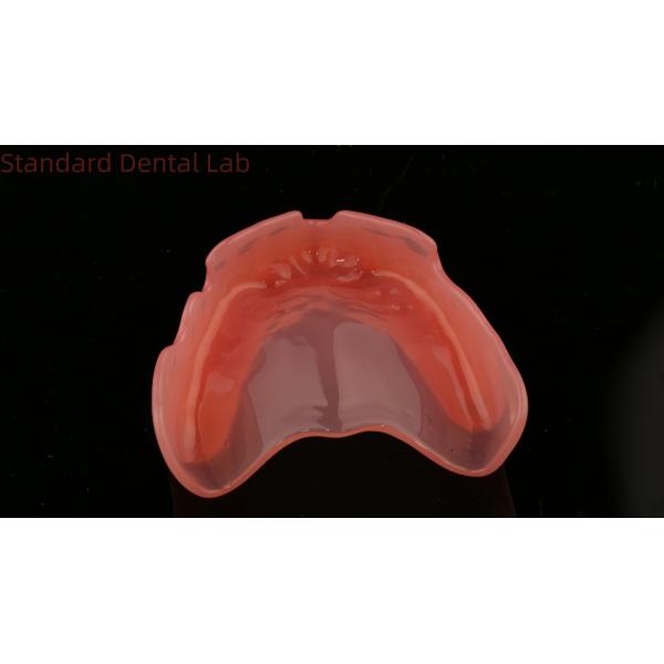 Complete Denture Ivoclar Full Denture Acrylic Teeth SDL Dental Lab