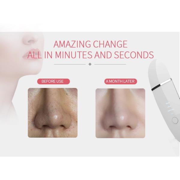Ultrasonic Skin Scrubber Spatula Blackhead Remover Pore Cleaner Face Scraper