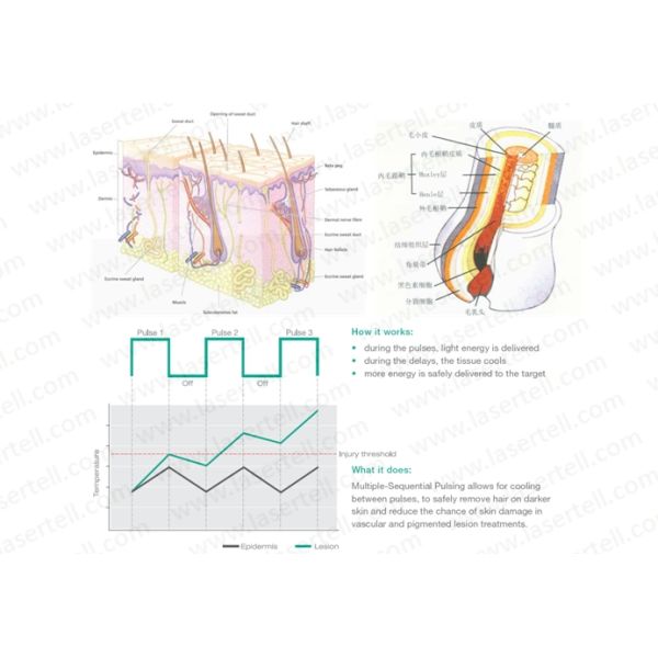 Vertical 3 Handles E light Beauty Machine for Clinic Acne Clearance Wrinkle Removal