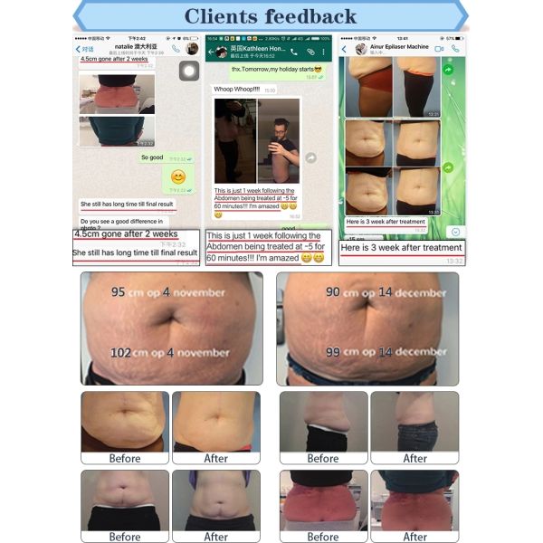 2018 hot sale 4 handles cryolipolysis Cryo Slimming cool shaping machine