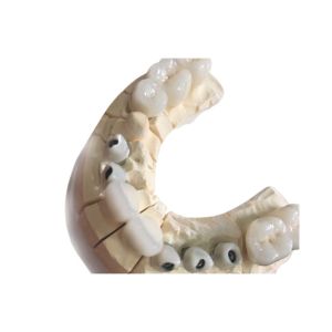 Cheap Metal Free White Zirconia Dental Crowns Excellent Biocompatibility wholesale