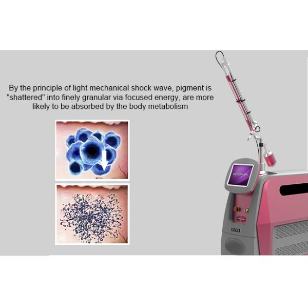 Professional Laser Tattoo Removal Machine Pigmentation Removal Picosecond Laser