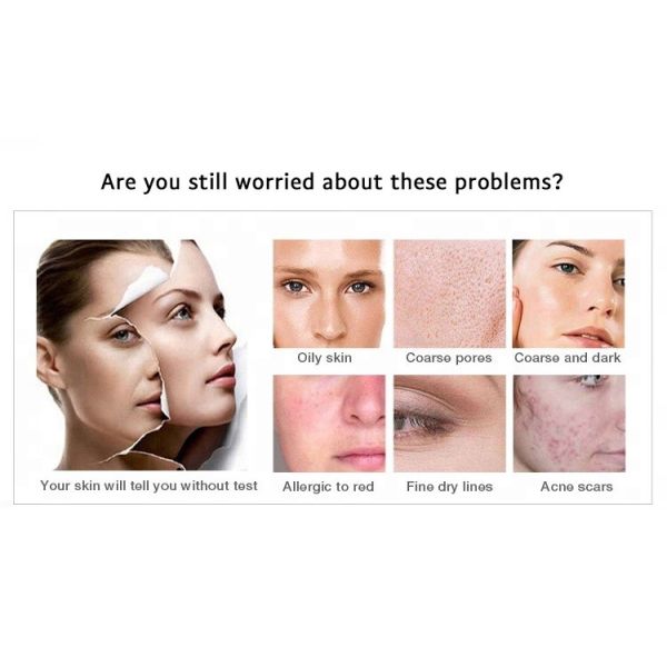 LF-832 Portable Aquasure H2 O2 bubble Machine Skin Rejuvenation blackhead removal Aquasure H2 Device for salon use